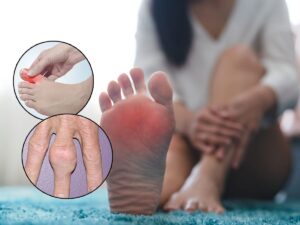 Foot pain and swelling in big toe with inset showing joint inflammation, indicating gout