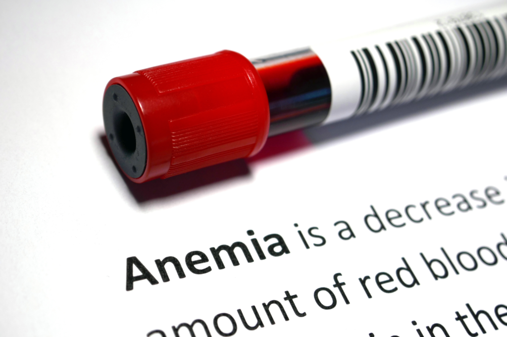 Close-up of a blood sample collection tube placed on a document describing anemia and reduced red blood cell levels.